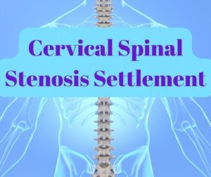 Cervical Spinal Stenosis Settlement