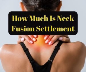 How Much Is Neck Fusion Settlement