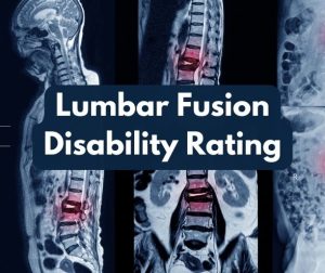 Lumbar Fusion Disability Rating