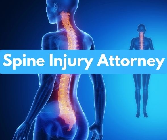Spine Injury Attorney